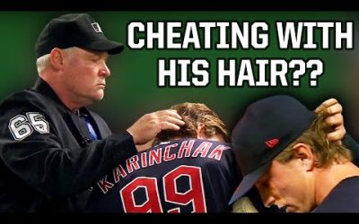 Pitcher accused of cheating via his hair, a breakdown