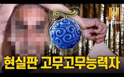 전세계에서 5천명당 1명꼴로 나타나는 고무인간?!💪 [역사 비하인드 : 언빌리버블]